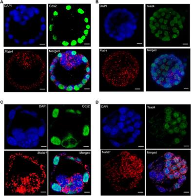 Simultaneous visualization of RNA transcripts and proteins in whole-mount mouse preimplantation embryos using single-molecule fluorescence in situ hybridization and immunofluorescence microscopy